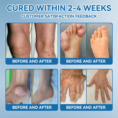 𝖯𝗂𝖼𝗱𝗼® BPC-157 Joint Healing Cream🦴Treats Arthritis, Neuropathy, Rheumatism, Sports Injuries & More🦶