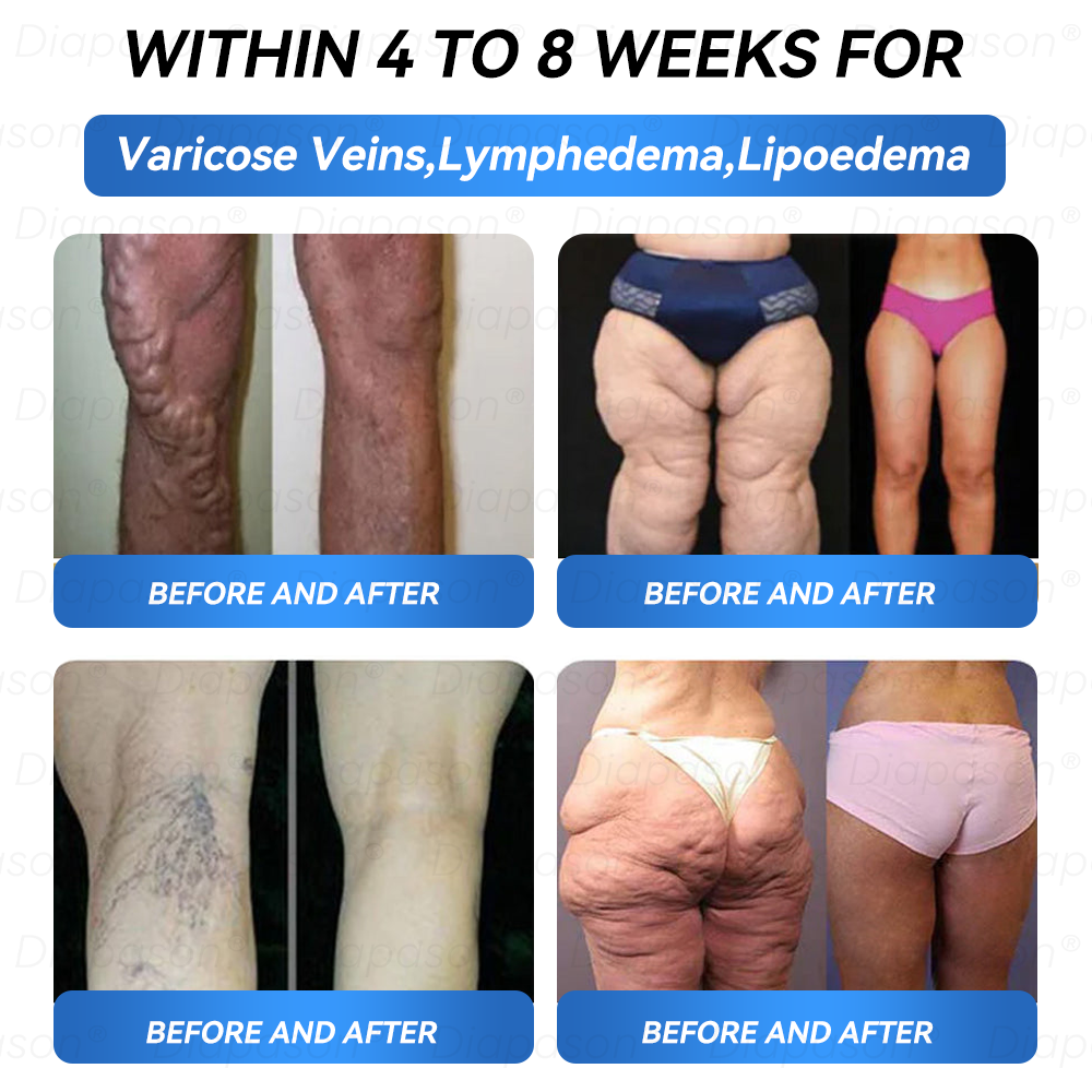 𝐃𝒊𝓪𝐩𝓪𝙨𝐨𝒏®🎁Congratulations! You’re one of our lucky winners! 💪 As our exclusive lucky star, you now get to enjoy an incredible 50% discount! Don’t miss out on this rare opportunity to treat yourself to something truly special!