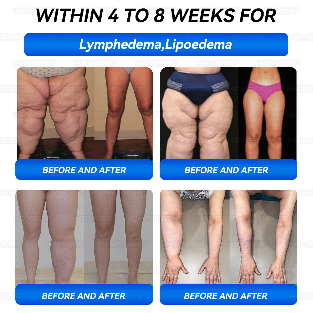 𝑲𝒆𝒚𝒆𝒔𝒔® 𝑮𝑳𝑷-1 𝑷𝒓𝒐𝒃𝒊𝒐𝒕𝒊𝒄 𝑭𝒖𝒍𝒍-𝑩𝒐𝒅𝒚 𝑺𝒄𝒖𝒍𝒑𝒕𝒊𝒏𝒈 & 𝑯𝒆𝒂𝒍𝒕𝒉 𝑩𝒐𝒐𝒔𝒕 𝑳𝒊𝒕𝒕𝒍𝒆 𝑩𝒍𝒖𝒆 𝑱𝒂𝒓 🌹