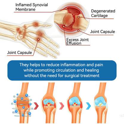 𝖯𝗂𝖼𝗱𝗼® BPC-157 Joint Healing Cream🦴Treats Arthritis, Neuropathy, Rheumatism, Sports Injuries & More🦶