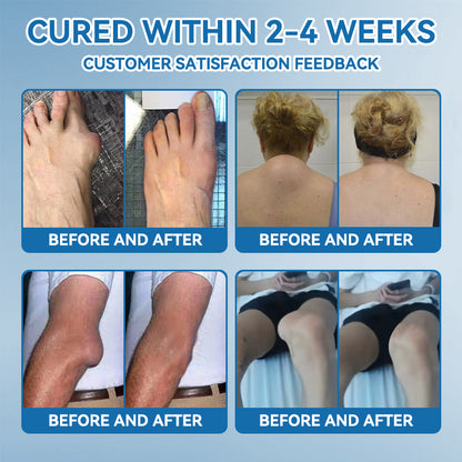 𝖯𝗂𝖼𝗱𝗼® BPC-157 Joint Healing Cream🦴Treats Arthritis, Neuropathy, Rheumatism, Sports Injuries & More🏆