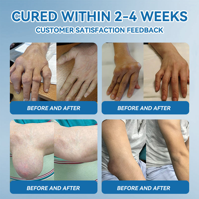 𝖯𝗂𝖼𝗱𝗼® BPC-157 Joint Healing Cream🦴Treats Arthritis, Neuropathy, Rheumatism, Sports Injuries & More🏆