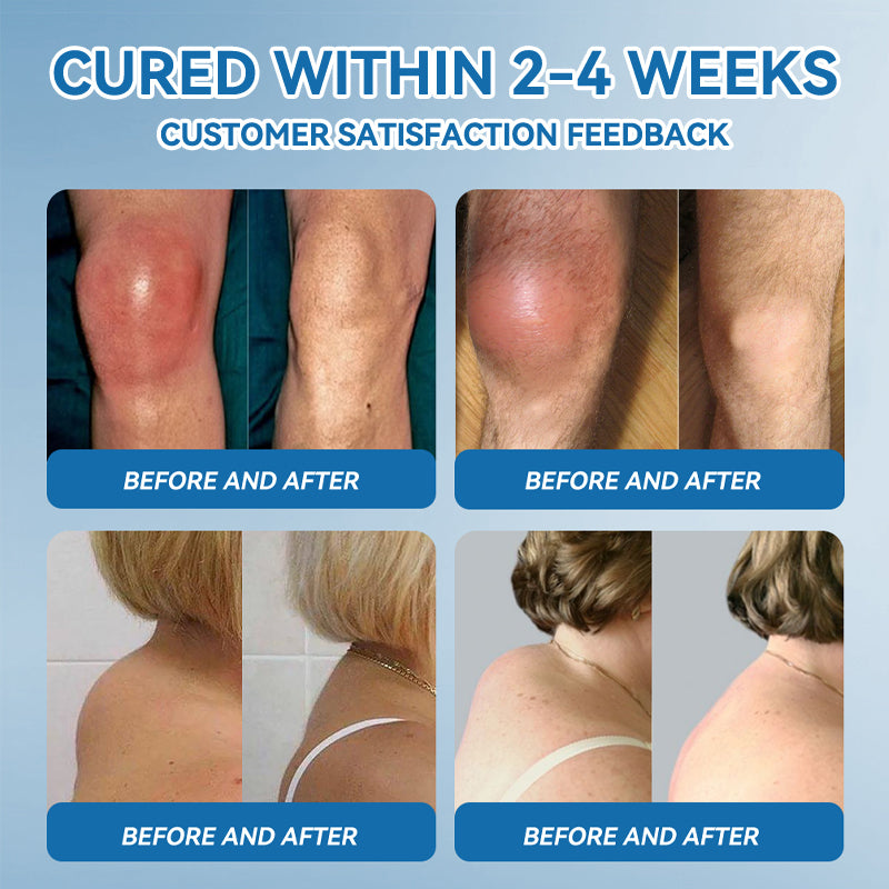 𝖯𝗂𝖼𝗱𝗼® BPC-157 Joint Healing Cream🦴Treats Arthritis, Neuropathy, Rheumatism, Sports Injuries & More🏆