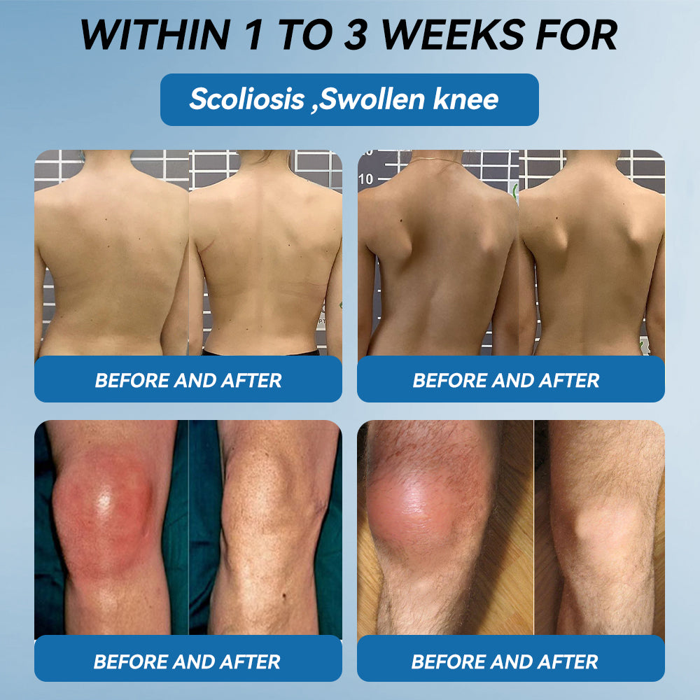 𝖯𝗂𝖼𝗱𝗼® BPC-157 Joint Healing Cream🦴Treats Arthritis, Neuropathy, Rheumatism, Sports Injuries & More🦶