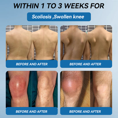 𝖯𝗂𝖼𝗱𝗼® BPC-157 Joint Healing Cream🦴Treats Arthritis, Neuropathy, Rheumatism, Sports Injuries & More🦶