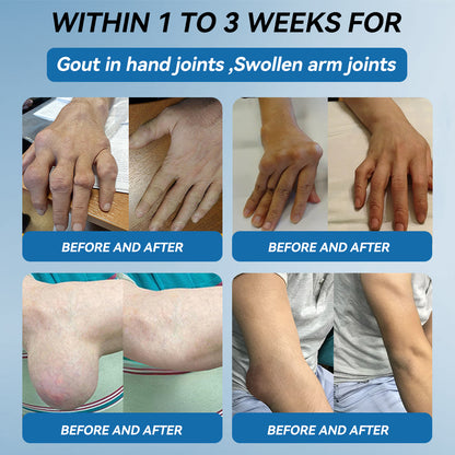 𝖯𝗂𝖼𝗱𝗼® BPC-157 Joint Healing Cream🦴Treats Arthritis, Neuropathy, Rheumatism, Sports Injuries & More🦶