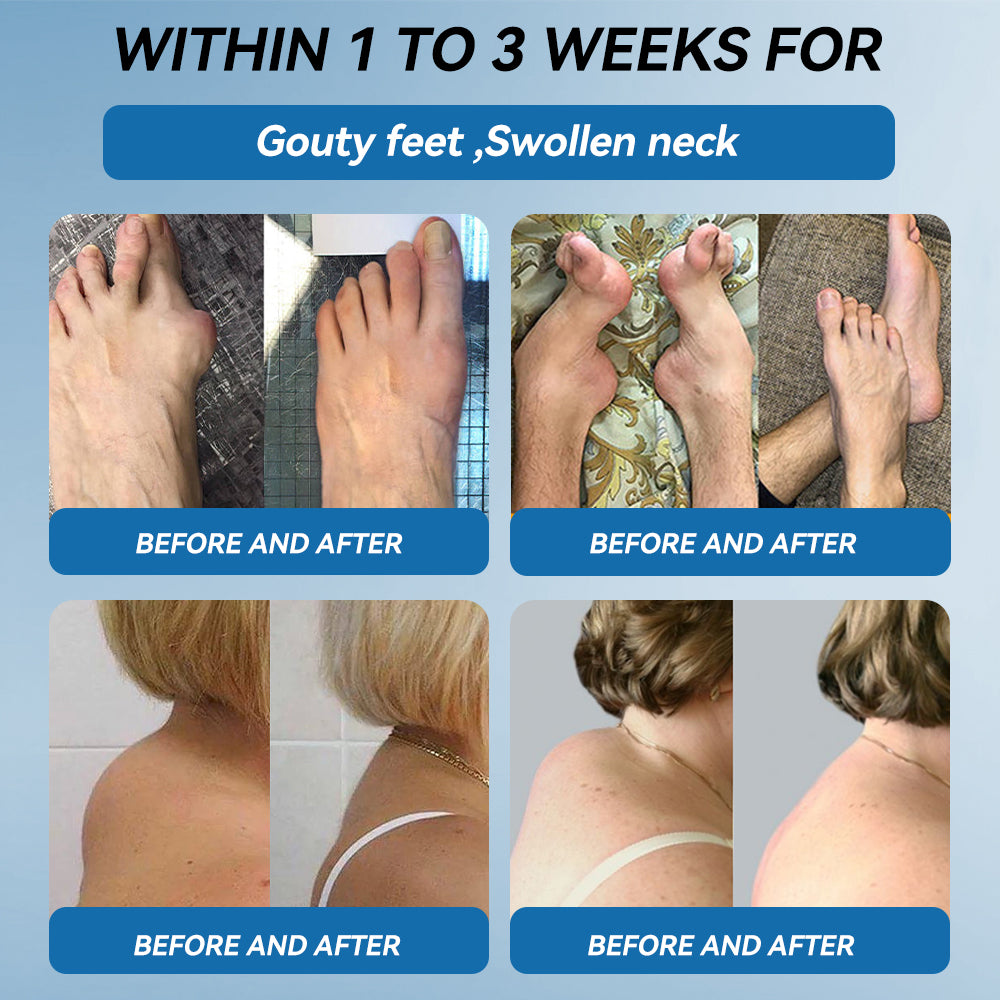 𝖯𝗂𝖼𝗱𝗼® BPC-157 Joint Healing Cream🦴Treats Arthritis, Neuropathy, Rheumatism, Sports Injuries & More🦶