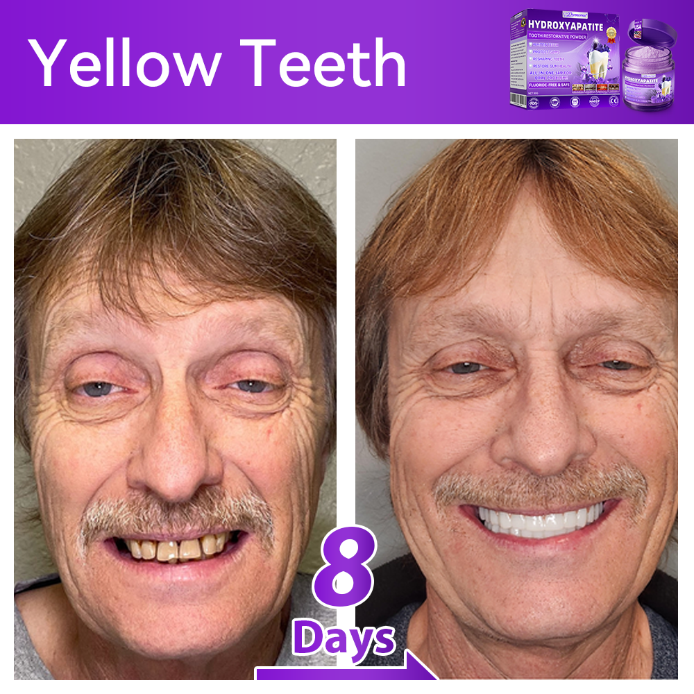 𝑫𝑜𝑟𝒎𝒐𝒓𝙣𝙖® 𝐻𝑦𝑑𝑟𝑜𝑥𝑦𝑎𝑝𝑎𝑡𝑖𝑡𝑒 𝑇𝑜𝑜𝑡ℎ 𝑅𝑒𝑠𝑡𝑜𝑟𝑎𝑡𝑖𝑣𝑒 𝑃𝑜𝑤𝑑𝑒𝑟🦷Treatment for dental caries, periodontal disease, tooth sensitivity, and oral cancer🏆