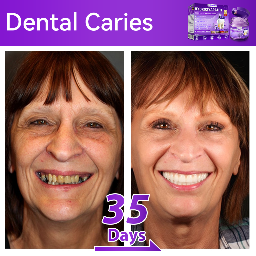 𝑫𝑜𝑟𝒎𝒐𝒓𝙣𝙖® 𝐻𝑦𝑑𝑟𝑜𝑥𝑦𝑎𝑝𝑎𝑡𝑖𝑡𝑒 𝑇𝑜𝑜𝑡ℎ 𝑅𝑒𝑠𝑡𝑜𝑟𝑎𝑡𝑖𝑣𝑒 𝑃𝑜𝑤𝑑𝑒𝑟🦷Treatment for dental caries, periodontal disease, tooth sensitivity, and oral cancer🏆