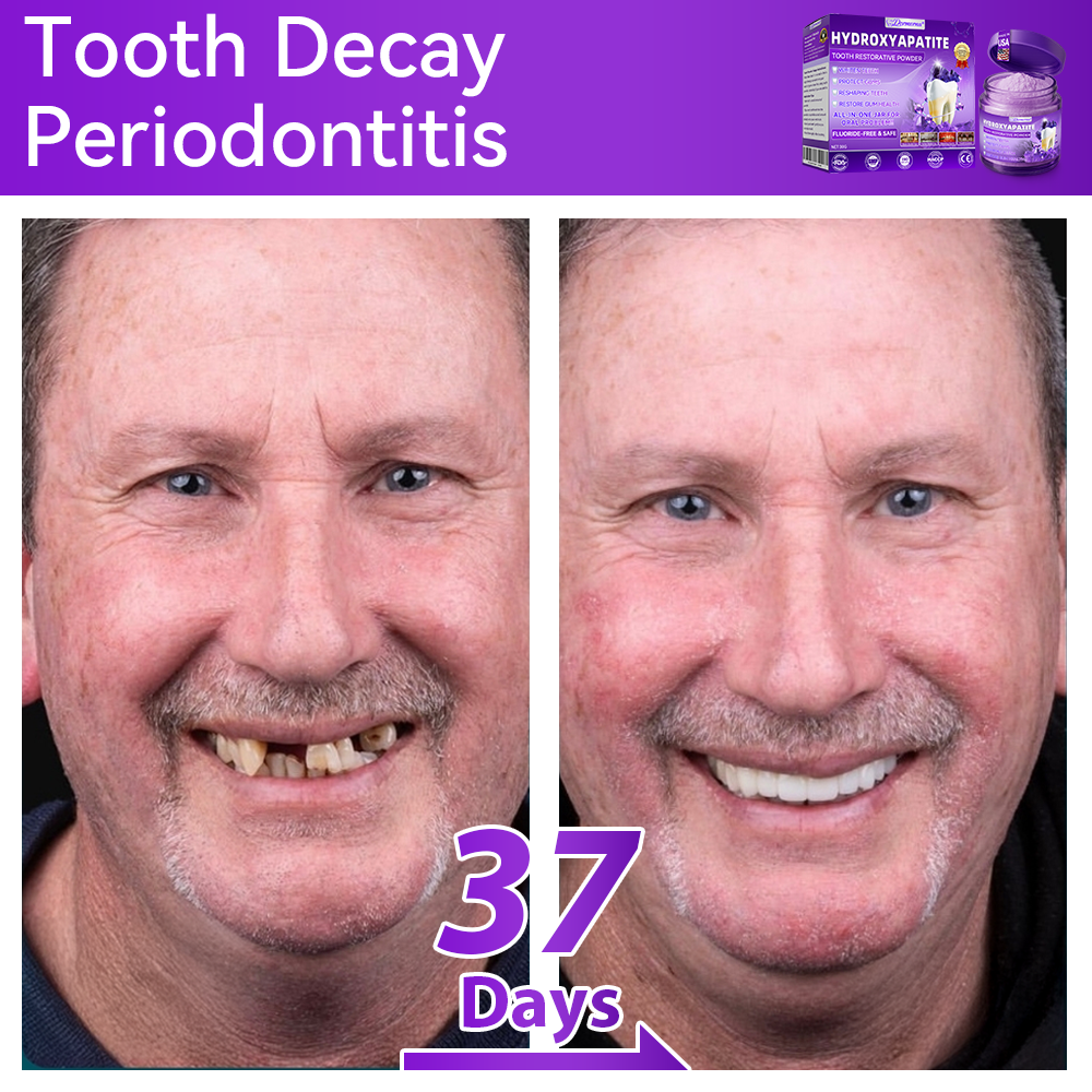 𝑫𝑜𝑟𝒎𝒐𝒓𝙣𝙖® 𝐻𝑦𝑑𝑟𝑜𝑥𝑦𝑎𝑝𝑎𝑡𝑖𝑡𝑒 𝑇𝑜𝑜𝑡ℎ 𝑅𝑒𝑠𝑡𝑜𝑟𝑎𝑡𝑖𝑣𝑒 𝑃𝑜𝑤𝑑𝑒𝑟🦷Treatment for dental caries, periodontal disease, tooth sensitivity, and oral cancer🏆