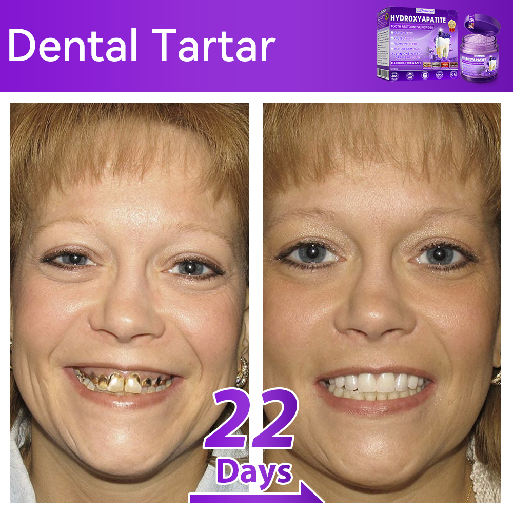 𝑫𝑜𝑟𝒎𝒐𝒓𝙣𝙖® 𝐻𝑦𝑑𝑟𝑜𝑥𝑦𝑎𝑝𝑎𝑡𝑖𝑡𝑒 𝑇𝑜𝑜𝑡ℎ 𝑅𝑒𝑠𝑡𝑜𝑟𝑎𝑡𝑖𝑣𝑒 𝑃𝑜𝑤𝑑𝑒𝑟🦷Treatment for dental caries, periodontal disease, tooth sensitivity, and oral cancer🏆