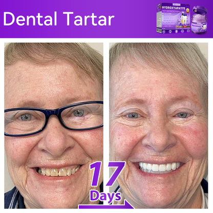 𝑫𝑜𝑟𝒎𝒐𝒓𝙣𝙖® 𝐻𝑦𝑑𝑟𝑜𝑥𝑦𝑎𝑝𝑎𝑡𝑖𝑡𝑒 𝑇𝑜𝑜𝑡ℎ 𝑅𝑒𝑠𝑡𝑜𝑟𝑎𝑡𝑖𝑣𝑒 𝑃𝑜𝑤𝑑𝑒𝑟🦷Treatment for dental caries, periodontal disease, tooth sensitivity, and oral cancer🏆