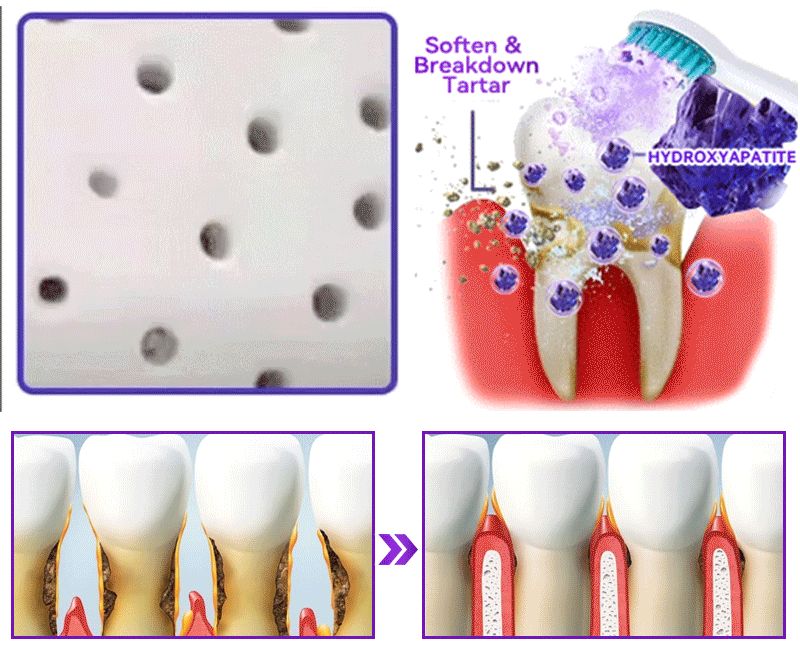 𝑫𝑜𝑟𝒎𝒐𝒓𝙣𝙖® 𝐻𝑦𝑑𝑟𝑜𝑥𝑦𝑎𝑝𝑎𝑡𝑖𝑡𝑒 𝑇𝑜𝑜𝑡ℎ 𝑅𝑒𝑠𝑡𝑜𝑟𝑎𝑡𝑖𝑣𝑒 𝑃𝑜𝑤𝑑𝑒𝑟🦷Treatment for dental caries, periodontal disease, tooth sensitivity, and oral cancer🏆