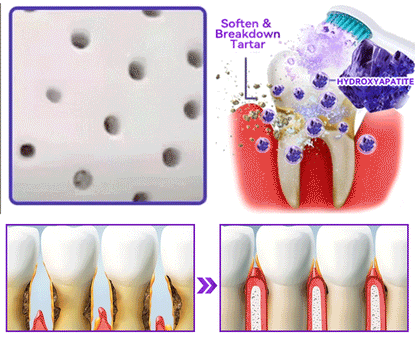 𝑫𝑜𝑟𝒎𝒐𝒓𝙣𝙖® 𝐻𝑦𝑑𝑟𝑜𝑥𝑦𝑎𝑝𝑎𝑡𝑖𝑡𝑒 𝑇𝑜𝑜𝑡ℎ 𝑅𝑒𝑠𝑡𝑜𝑟𝑎𝑡𝑖𝑣𝑒 𝑃𝑜𝑤𝑑𝑒𝑟🦷Treatment for dental caries, periodontal disease, tooth sensitivity, and oral cancer🏆